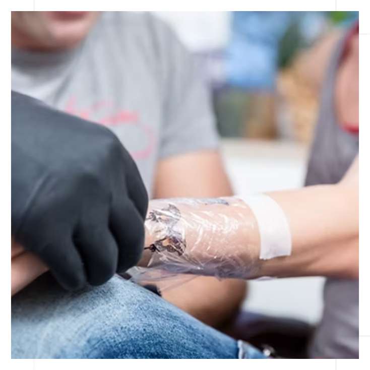after-session-treatment